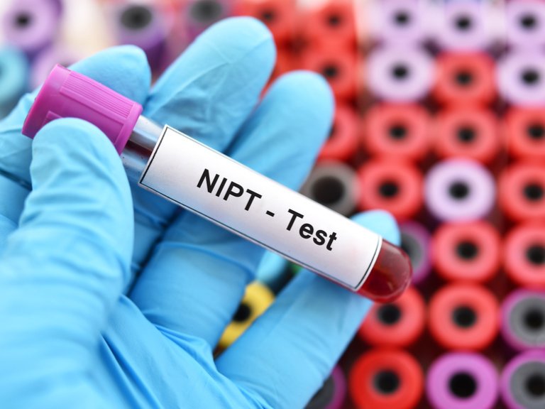 NIPT detects cytomegalovirus virus dangerous to fetus