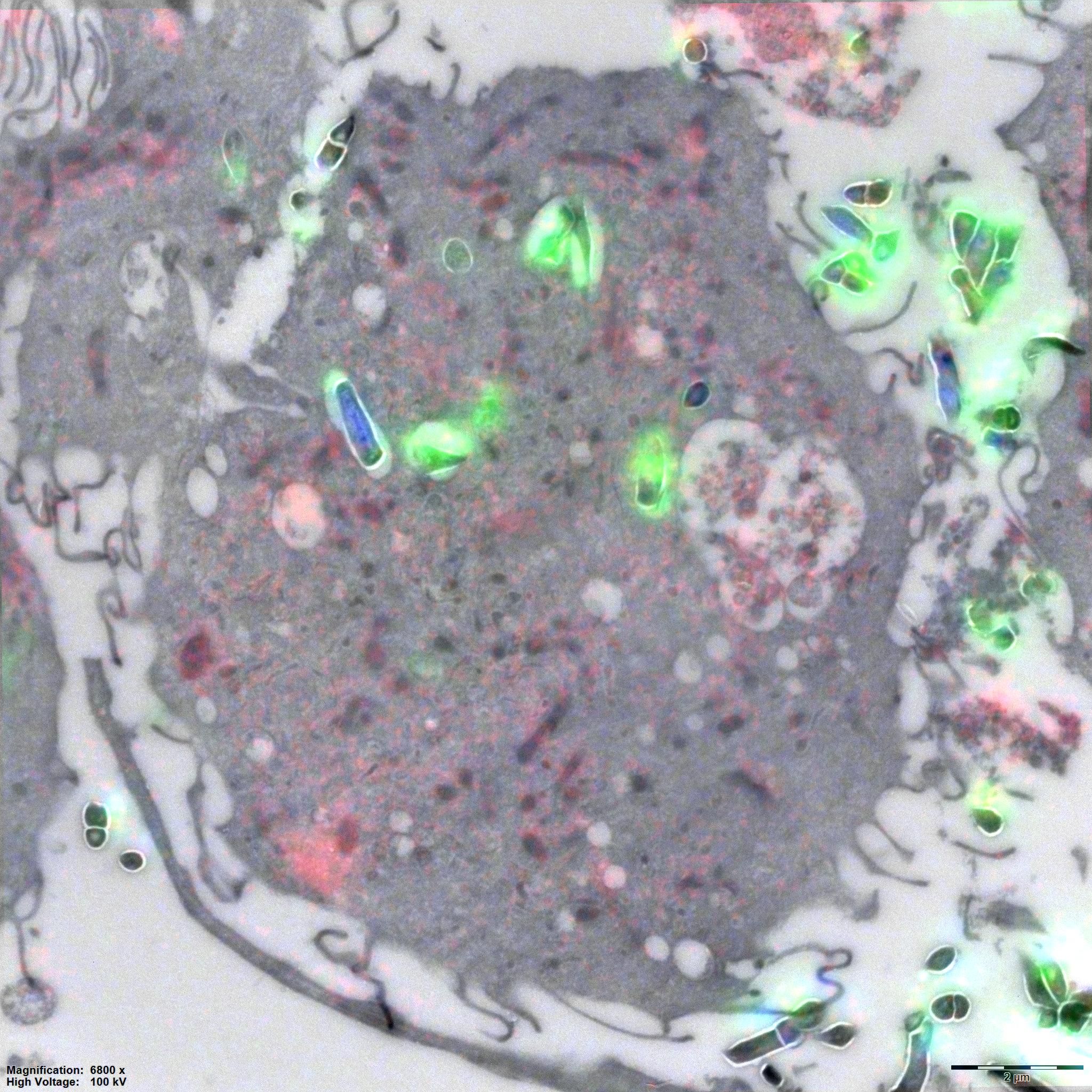 The figure shows a tuberculosis infected immune cell. A thin section of the infected immune cell was imaged using both a fluorescent microscope and thereafter an electron microscope. Images of both techniques are combined in this image, to indicate the localization of the bacteria in green, DNA in bleu and lipids in red. 