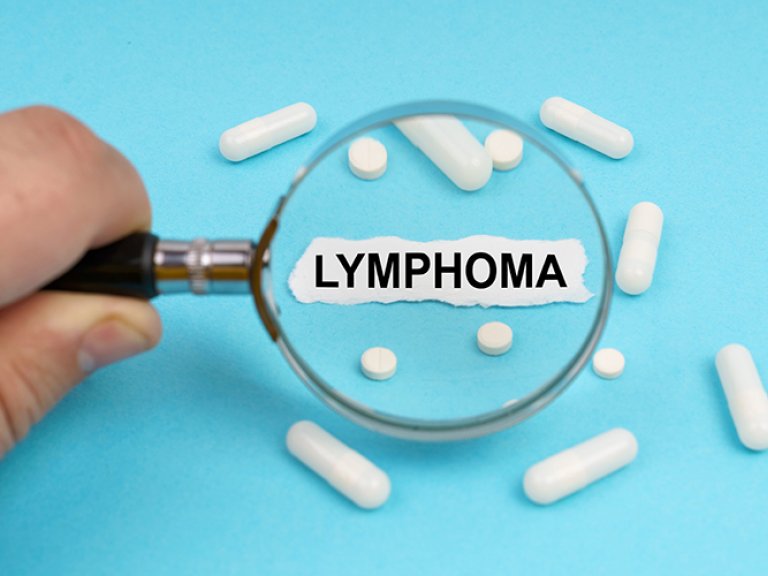 NWO Grant awarded for innovative 3D and AI-driven lymphoma research