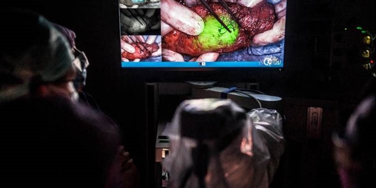 Veelbelovende behandeling darmkanker  