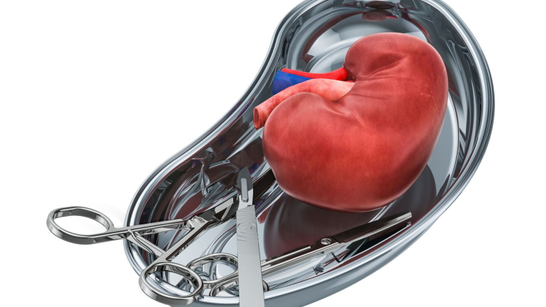Succesvolle niertransplantatie in Suriname