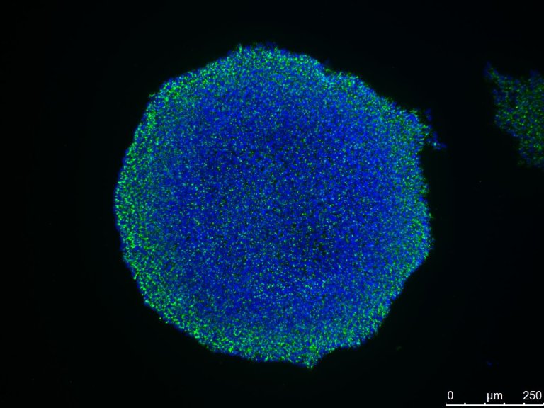 Induced Pluripotent Stem Cells