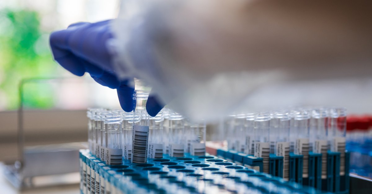 New biomarker helps differentiate underlying pathologies of ...
