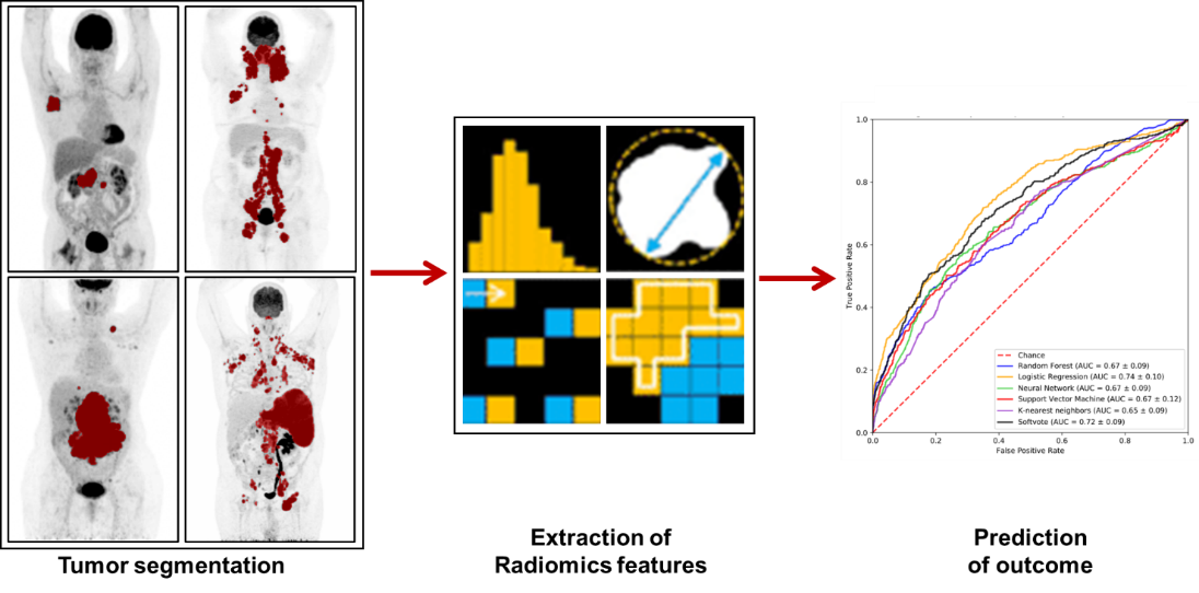 Radiomics pipeline – automated delineation of lesions on FDG PET/CT followed with feature extraction providing information on shape, size, tracer uptake distribution and texture and, finally, use of these features as input for prediction with a model