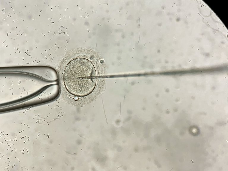 Nieuwe IVF-methode wel duurder niet beter