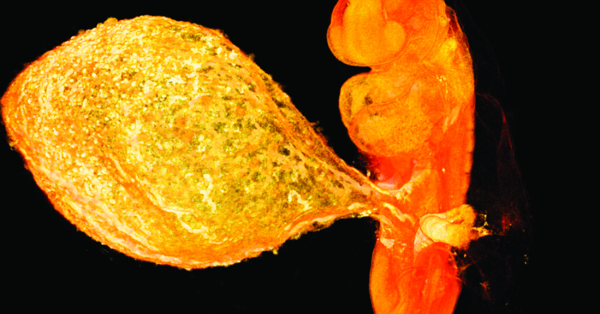 First-ever crystal clear image of 6-week-old embryo | Amsterdam UMC