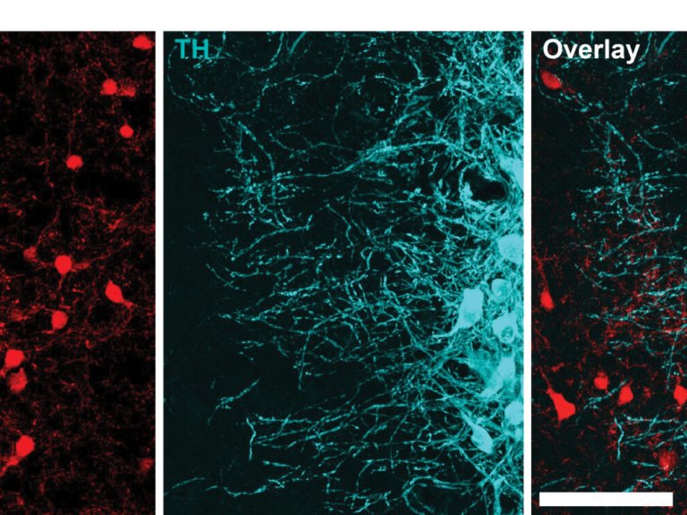 Peptidergic control of the brain’s stress system modulates anxiety 