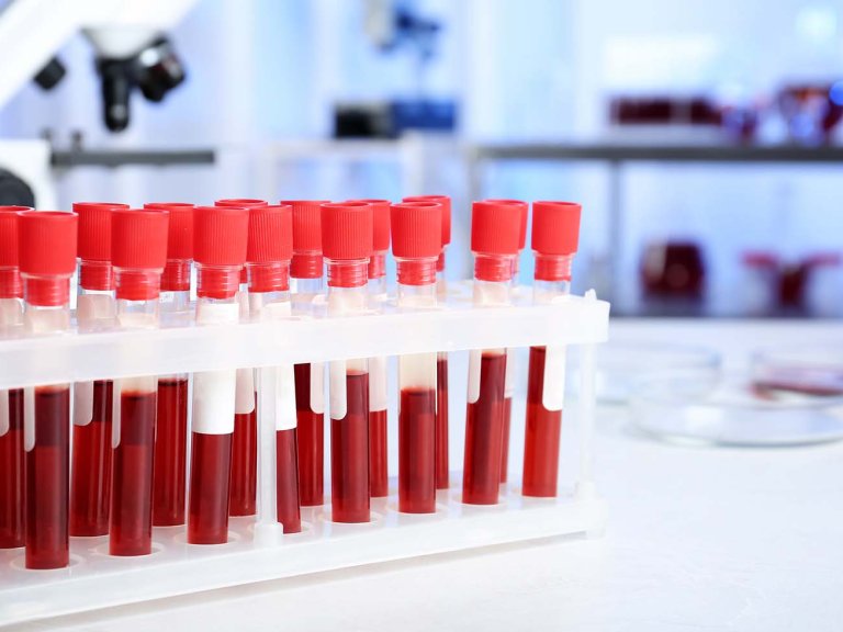 New study confirms reliability of flow cytometry MRD testing in older AML patients