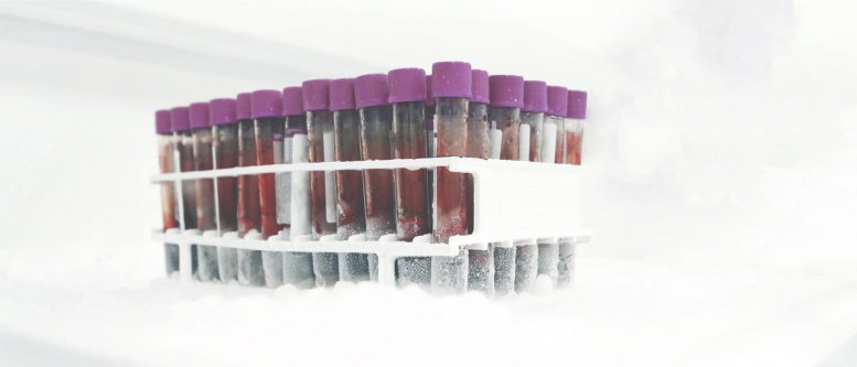 Biobank