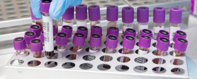Amsterdam UMC Biobank