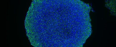 Induced Pluripotent Stem Cells