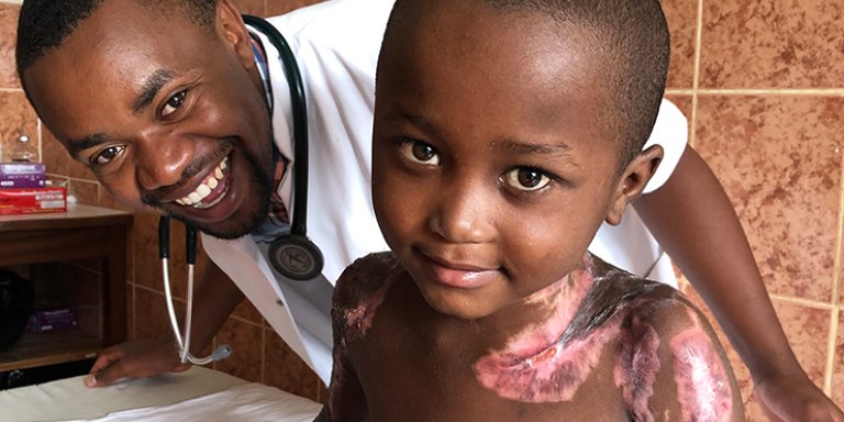 Brandwonden opereren in Tanzania: meer aandacht voor nazorg