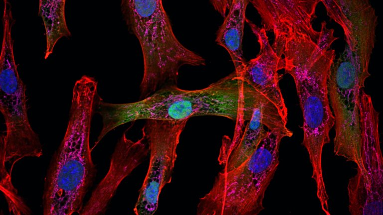 Met microscopie is het mogelijk om processen in levende cellen zichtbaar te maken