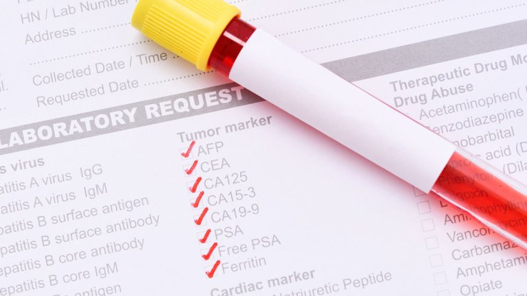 Biomarker and Test Evaluation (BiTE) projects