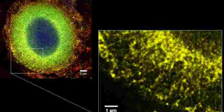 Nieuwste inzichten vorming Lewy bodies bij parkinson