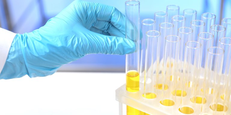 Ruiken aan urine om naadlekkage te vinden