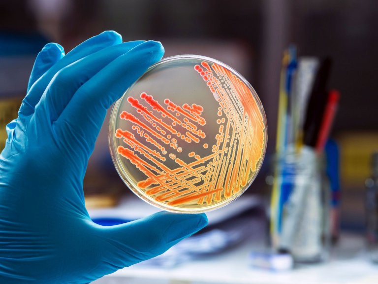 Hidden bacteria presents a substantial risk of antimicrobial resistant infection in hospital patients 