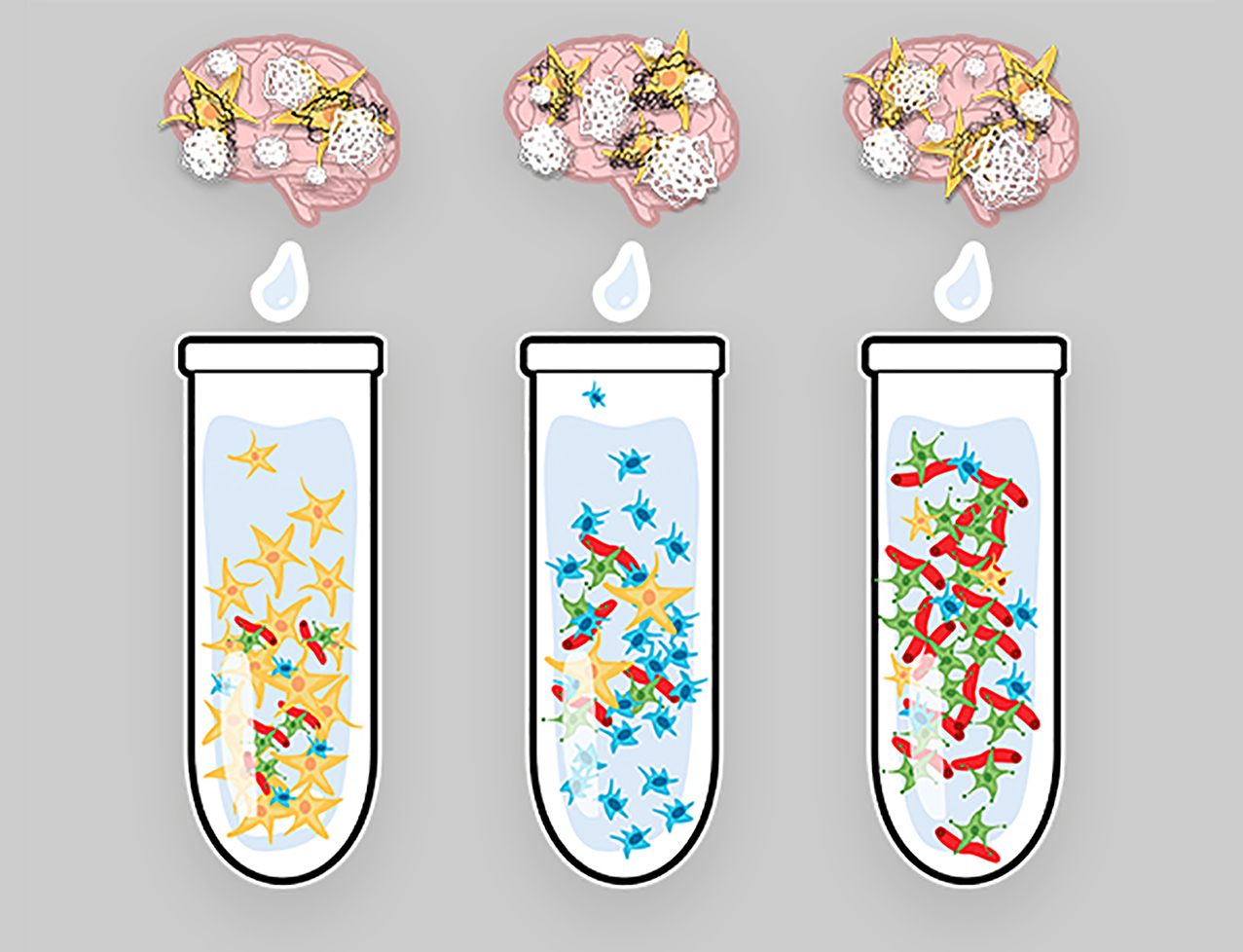 Distinct biological variants discovered in Alzheimer’s disease