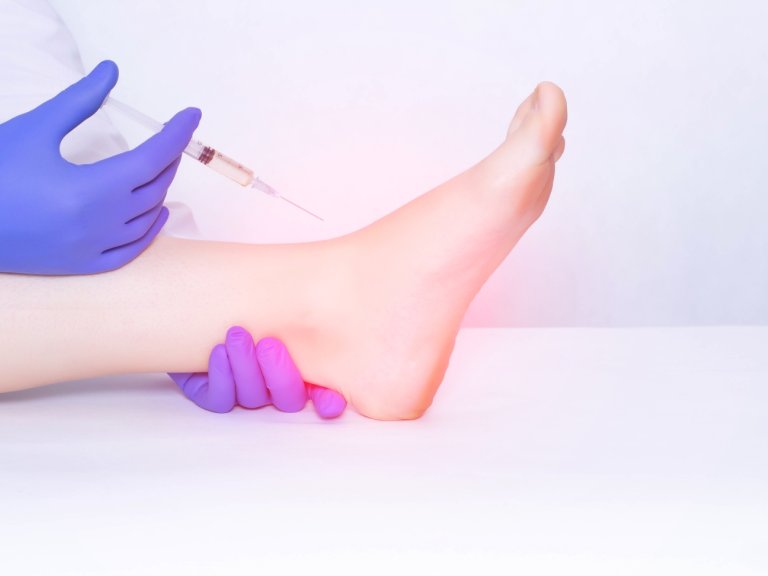 Injections with Platelet Rich Plasma not effective for ankle osteoarthritis patients