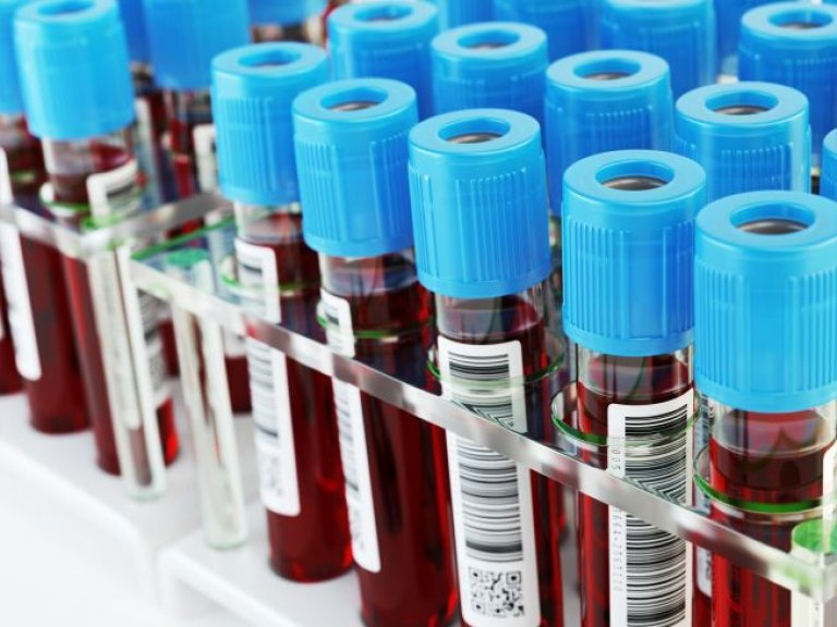 Can we detect colon cancer based on a blood sample?