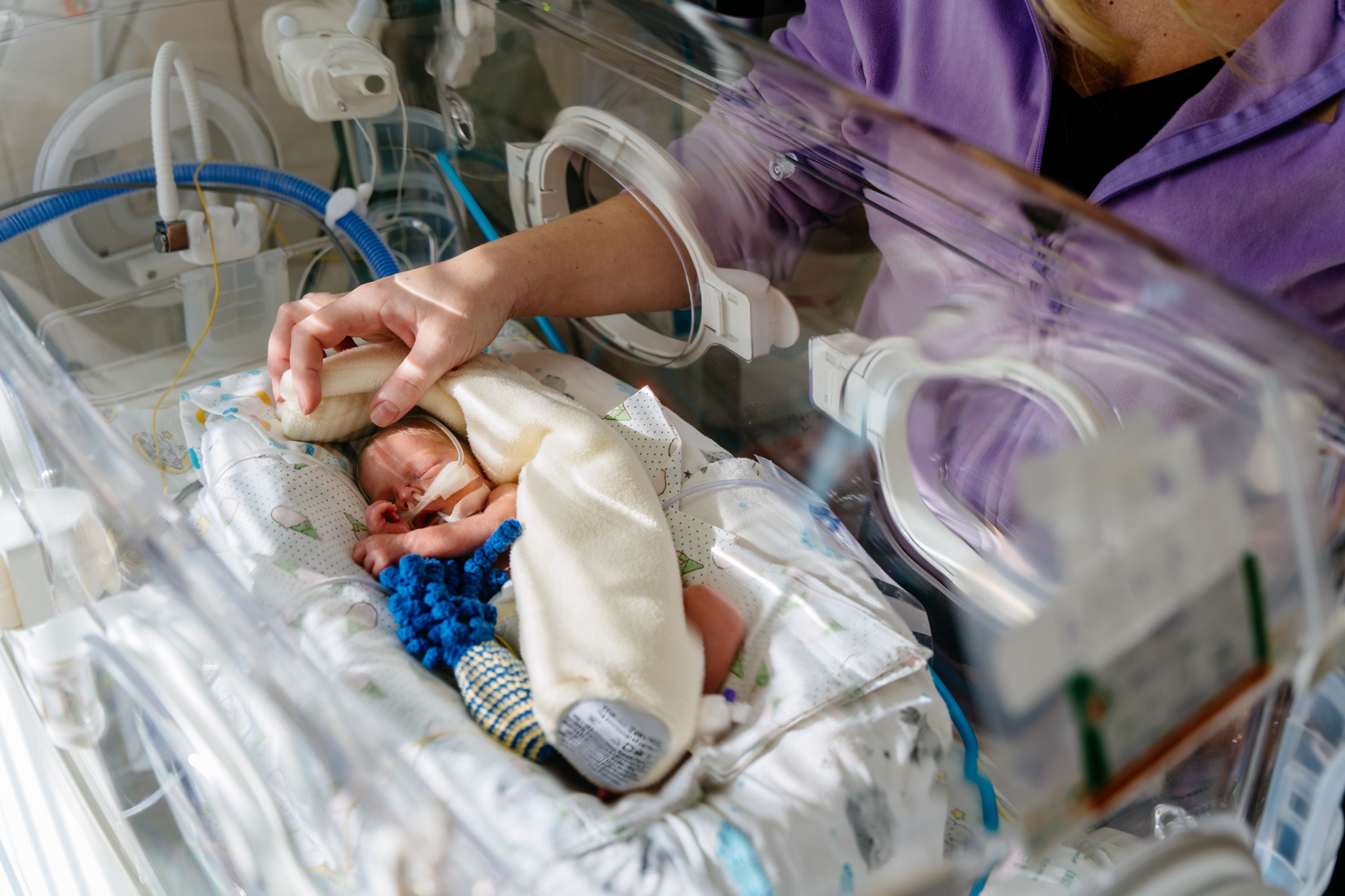 Veel ouders van zeer vroeg geboren baby&rsquo;s houden zware stressklachten