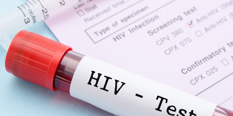 Discovery of new more infectious HIV variant