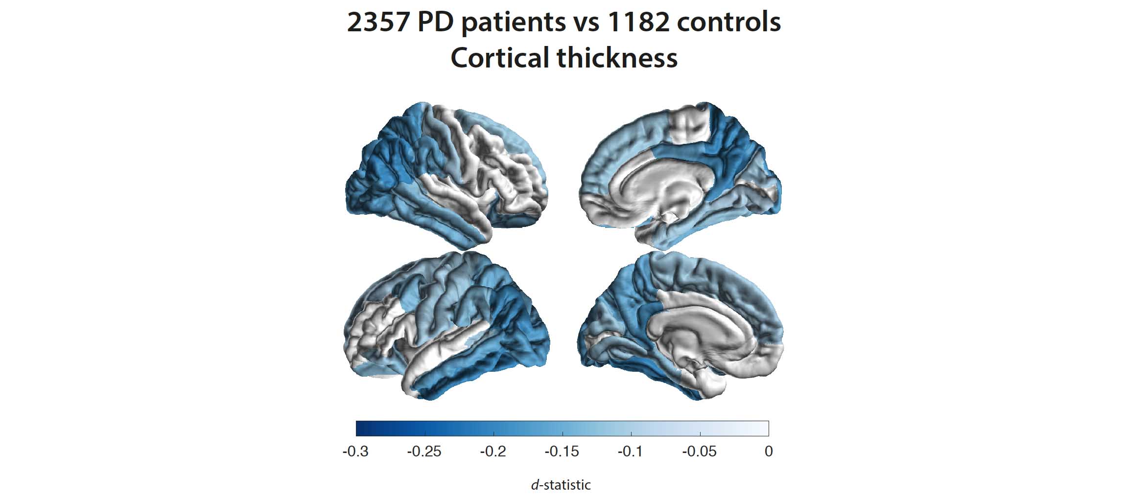 Graphic illustration of the brain supported by a cortical thickness scale