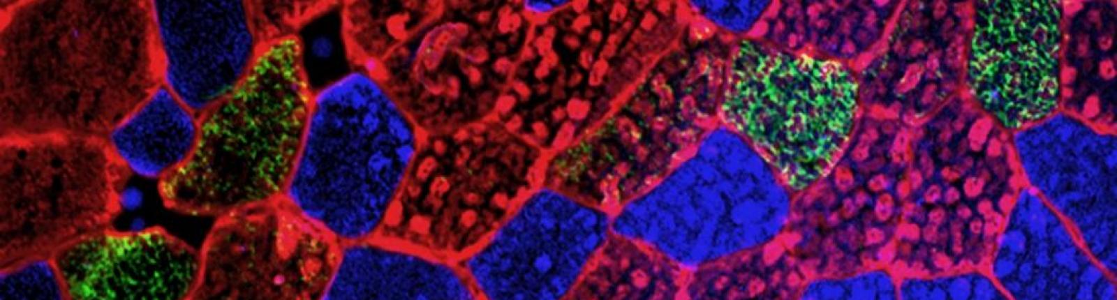Contribute to research into long covid!