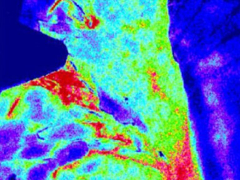 Optical imaging