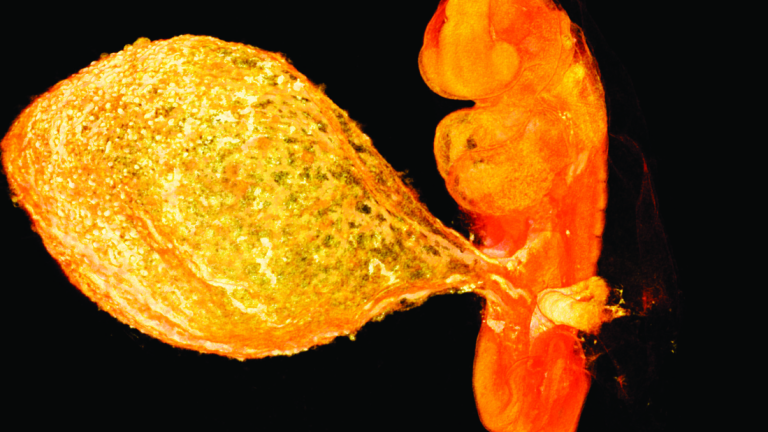 Voor het eerst haarscherp beeld van 6 weken oud embryo