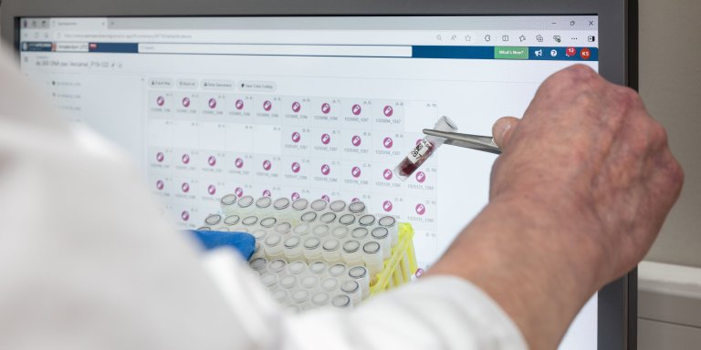 Snellere analyse van leukemiecellen met AI