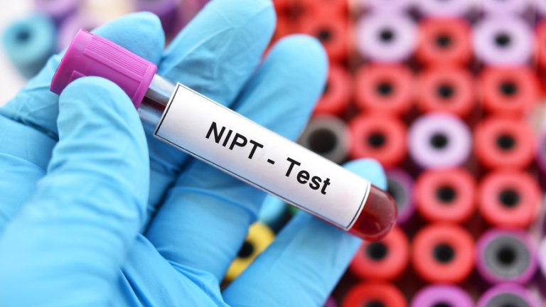I didn't want to lose this child: NIPT screening test did not exclude Down child from society, as some feared – Article by De Volkskrant 