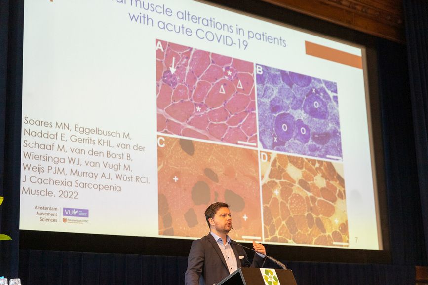 Dr. Rob Wust and colleagues' study reveals insights into Post-COVID fatigue