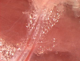 Human peri-vascular adipose tissue (PVAT)