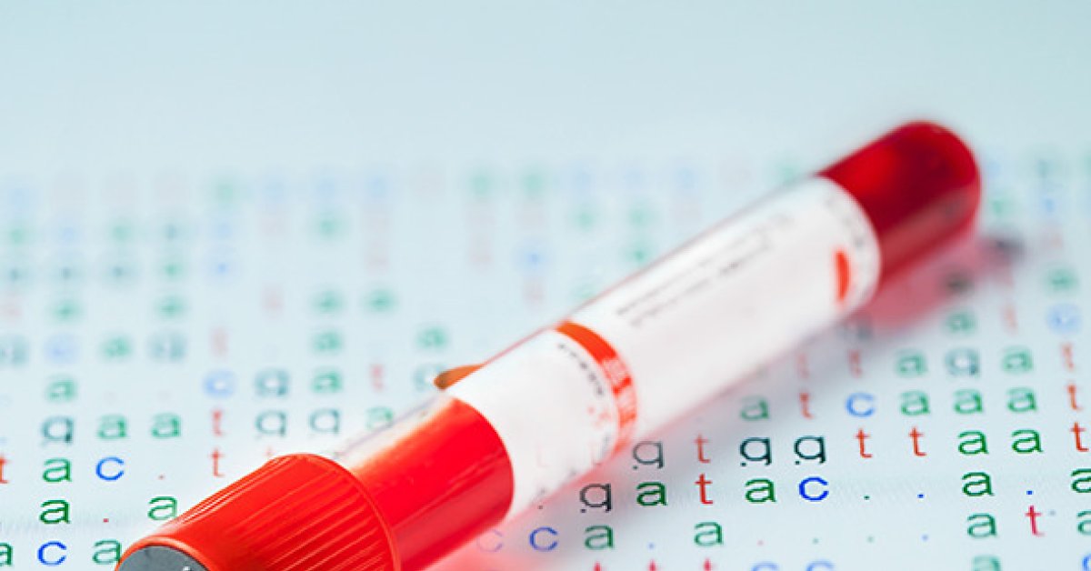Monitoring of brain tumor patients with a single drop of blood ...