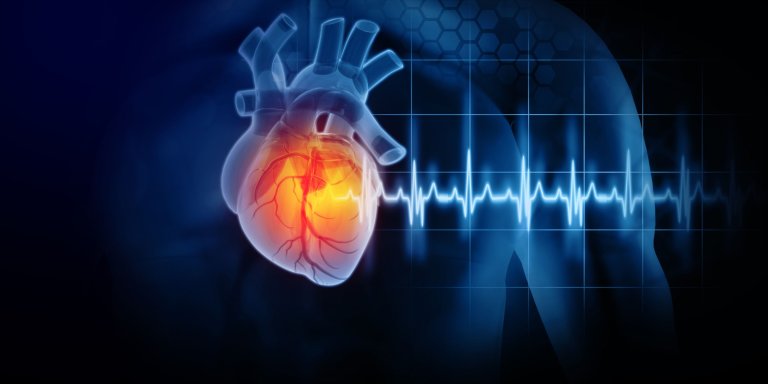 Transgender vrouwen hebben géén verhoogd risico op hartinfarct en beroerte