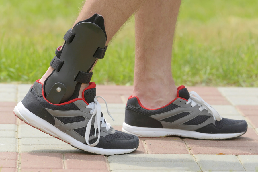 ZonMW VIMP grant for setting up Dutch orthosis network